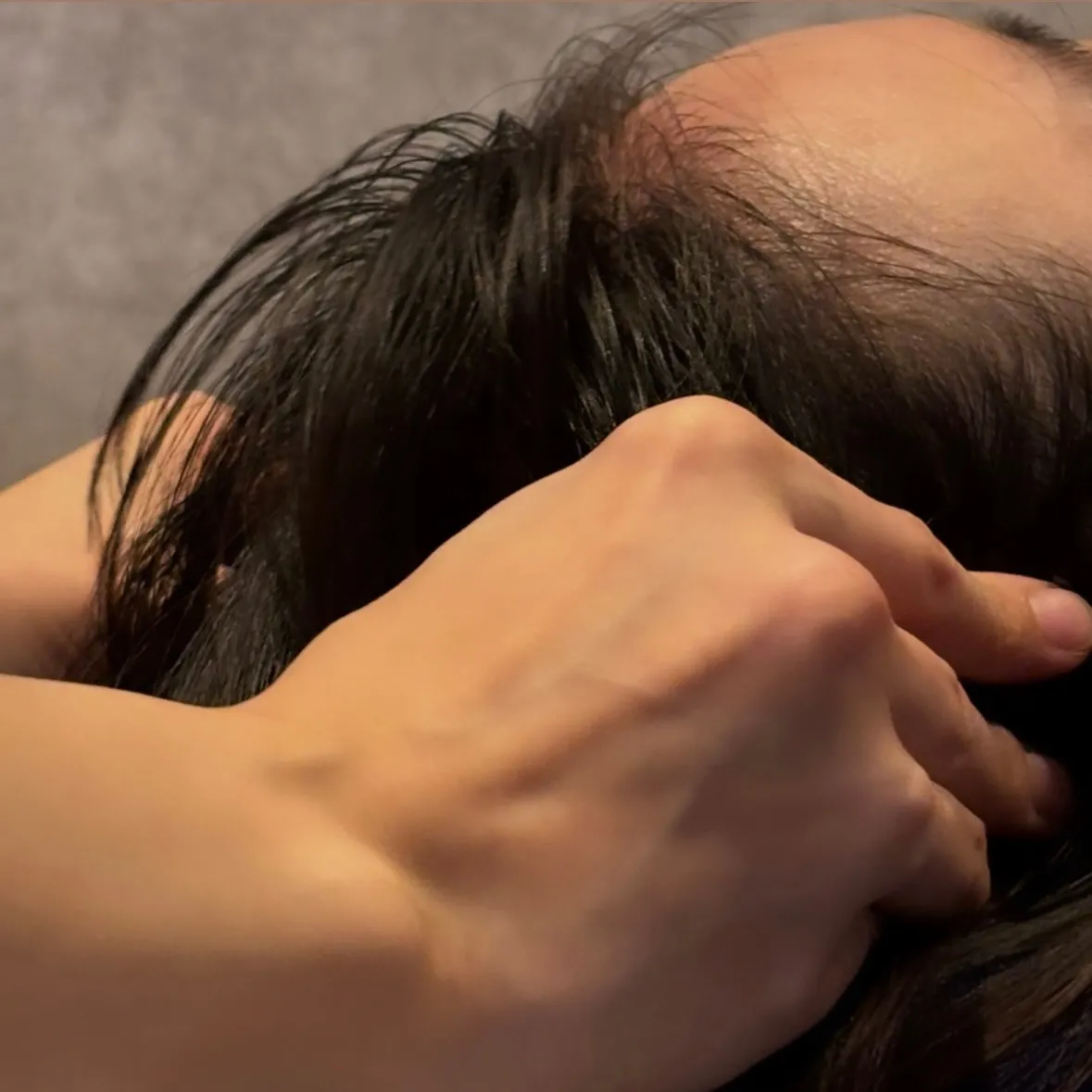 ブライダル前に💍憧れの小顔へ♪